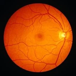 AI Enhances Retinal Imaging Speed and Precision